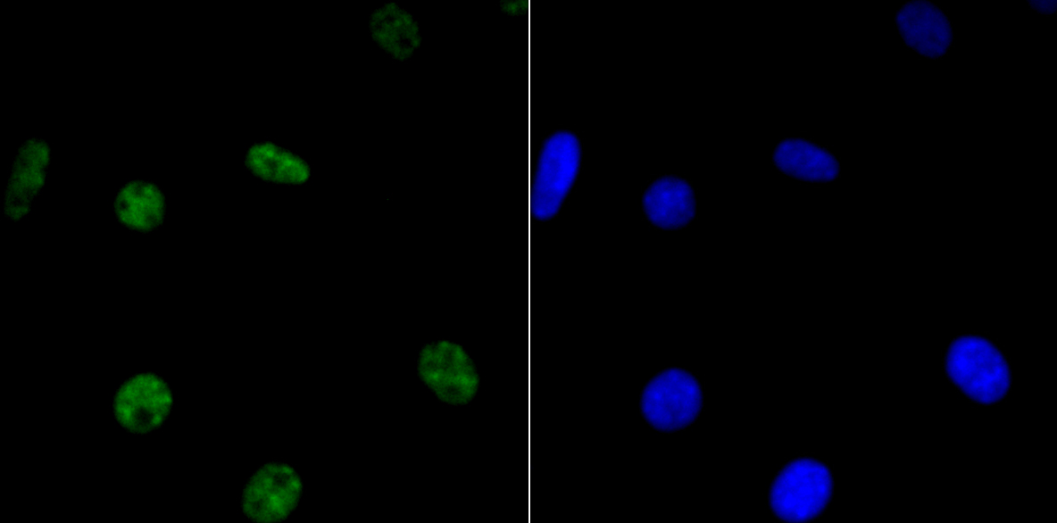 IF(ICC) staining with HDAC9 (2C9) Monoclonal Antibody (bsm-54186R) at 1:100 in SH-SY5Y cells (green). The nuclear counterstain is DAPI (blue). Cells were fixed in paraformaldehyde, permeabilized with 0.25% Triton X100/PBS.