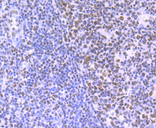 Paraformaldehyde-fixed and paraffin-embedded Human Tonsil tissue incubated with HDAC9 (2C9) Monoclonal Antibody (bsm-54186R) at 1:100, overnight at 4°C, followed by a conjugated secondary antibody and DAB staining. Counterstained with hematoxylin.