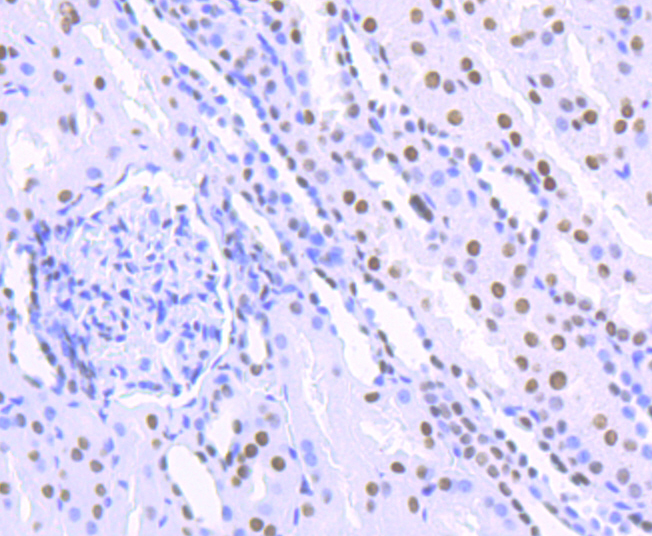 Paraformaldehyde-fixed and paraffin-embedded Human Kidney tissue incubated with HDAC9 (2C9) Monoclonal Antibody (bsm-54186R) at 1:100, overnight at 4°C, followed by a conjugated secondary antibody and DAB staining. Counterstained with hematoxylin.