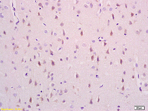 Formalin-fixed and paraffin embedded rat brain labeled with Anti phospho-NDEL1(Ser231) Polyclonal Antibody,Unconjugated (bs-5522R) at 1:200 followed by conjugation to the secondary antibody and DAB staining.