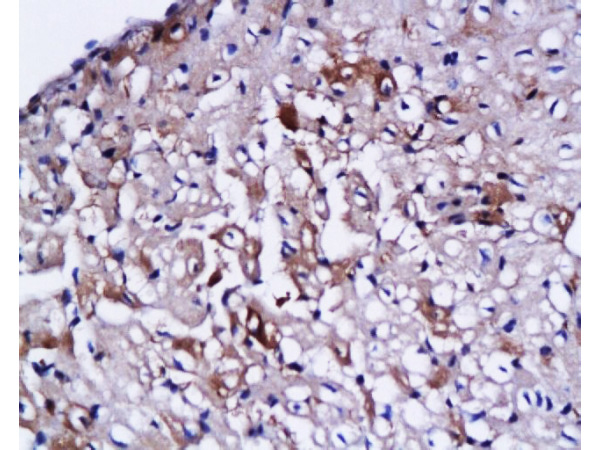 Formalin-fixed and paraffin embedded rabbit heart labeled with Anti CTn1/Troponin I/TNNC1 Polyclonal Antibody,Unconjugated (bs-0799R) at 1:200 followed by conjugation to the secondary antibody and DAB staining. Formalin-fixed and paraffin embedded rabbit heart labeled with Anti CTn1/Troponin I/TNNC1 Polyclonal Antibody,Unconjugated (bs-0799R) at 1:200 followed by conjugation to the secondary antibody and DAB staining.