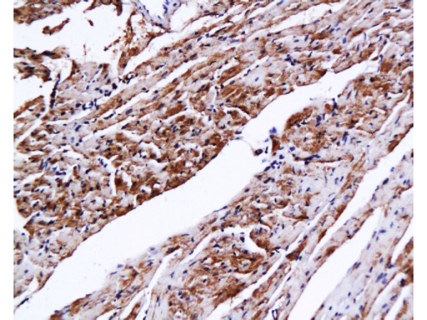 Formalin-fixed and paraffin embedded mouse heart tissue with Anti-CTn1/Troponin I/TNNC1 Polyclonal Antibody, Unconjugated (bs-0799R) at 1:200, followed by conjugation to the secondary antibody and DAB staining