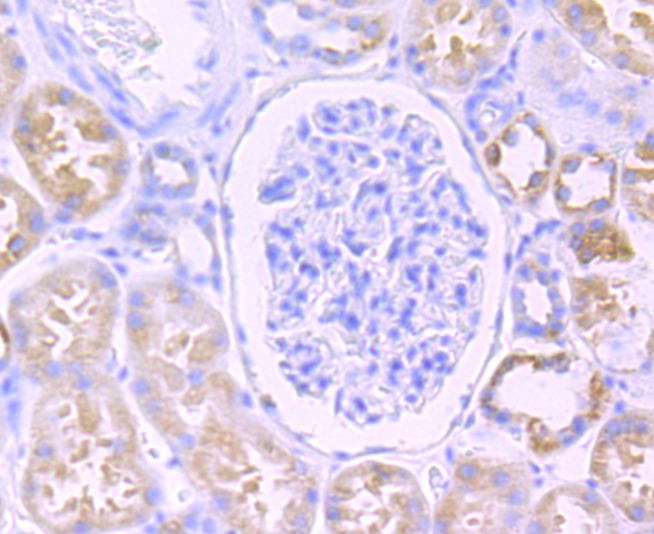 Paraformaldehyde-fixed and paraffin-embedded Human Kidney tissue incubated with Citrate synthase (3C3) Monoclonal Antibody (bsm-54190R) at 1:100, overnight at 4°C, followed by a conjugated secondary antibody and DAB staining. Counterstained with hematoxylin.