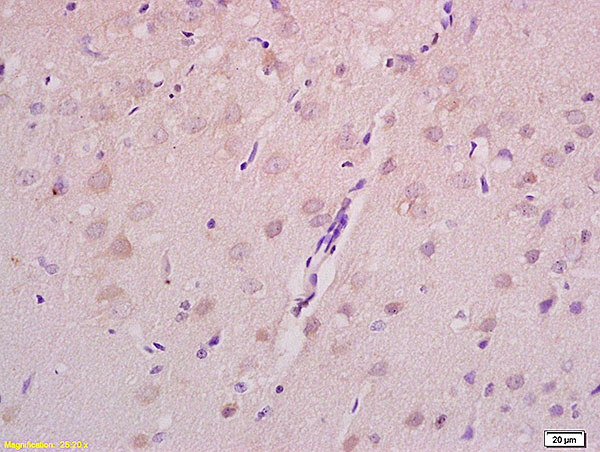 Formalin-fixed and paraffin embedded rat brain tissue labeled with Anti Axin 2 Polyclonal Antibody,Unconjugated (bs-5717R) at 1:200 followed by conjugation to the secondary antibody and DAB staining.