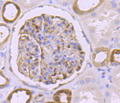 Paraformaldehyde-fixed and paraffin-embedded Human Kidney tissue incubated with BST2 (1C3) Monoclonal Antibody (bsm-54196R) at 1:100, overnight at 4°C, followed by a conjugated secondary antibody and DAB staining. Counterstained with hematoxylin.