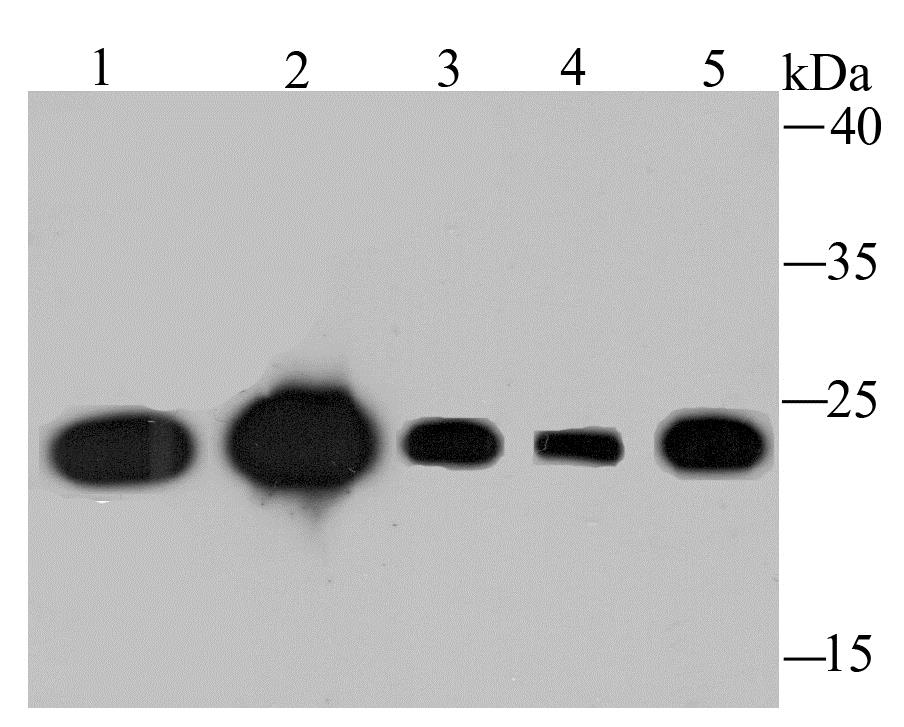 Lane 1: Mouse Placenta; Lane 2: Mouse Testis; Lane 3: Hela Cells; Lane 4: A431 Cells; Lane 5: MCF-7 Cells; Probed with TPT1 (7C1) Monoclonal Antibody (bsm-54198R) at 1:1000 overnight at 4°C followed by a conjugated secondary antibody for 60 minutes at 37°C.