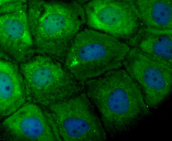 IF(ICC) staining with TPT1 (7C1) Monoclonal Antibody (bsm-54198R) at 1:100 in A431 cells (green). The nuclear counterstain is DAPI (blue). Cells were fixed in paraformaldehyde, permeabilized with 0.25% Triton X100/PBS.