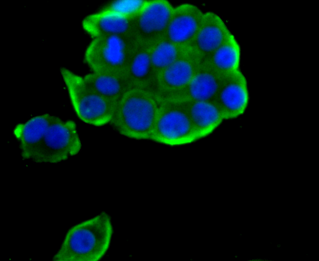 IF(ICC) staining with TPT1 (7C1) Monoclonal Antibody (bsm-54198R) at 1:100 in LOVO cells (green). The nuclear counterstain is DAPI (blue). Cells were fixed in paraformaldehyde, permeabilized with 0.25% Triton X100/PBS.