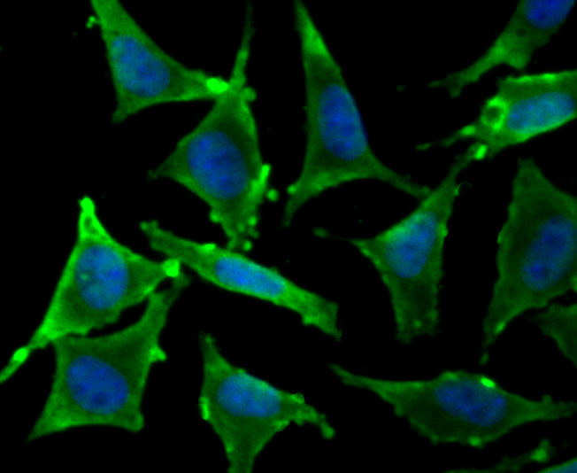 IF(ICC) staining with TPT1 (7C1) Monoclonal Antibody (bsm-54198R) at 1:100 in SH-SY5Y cells (green). The nuclear counterstain is DAPI (blue). Cells were fixed in paraformaldehyde, permeabilized with 0.25% Triton X100/PBS.