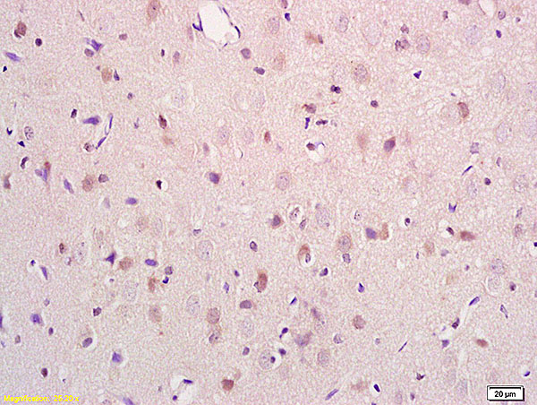 Formalin-fixed and paraffin embedded rat brain tissue labeled with Anti PRODH Polyclonal Antibody,Unconjugated (bs-5813R) at 1:200 followed by conjugation to the secondary antibody and DAB staining.