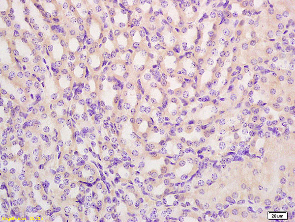 Formalin-fixed and paraffin embedded mouse kidney tissue labeled with Anti PRODH Polyclonal Antibody,Unconjugated (bs-5813R) at 1:200 followed by conjugation to the secondary antibody and DAB staining.