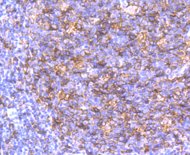 Paraformaldehyde-fixed and paraffin-embedded Human Tonsil tissue incubated with HLA-DQA1 (8C1) Monoclonal Antibody (bsm-54201R) at 1:100, overnight at 4°C, followed by a conjugated secondary antibody and DAB staining. Counterstained with hematoxylin.