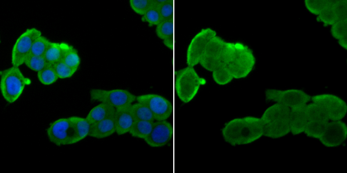 IF(ICC) staining with THOC1 (7G3) Monoclonal Antibody (bsm-54202R) at 1:100 in LOVO cells (green). The nuclear counterstain is DAPI (blue). Cells were fixed in paraformaldehyde, permeabilized with 0.25% Triton X100/PBS.