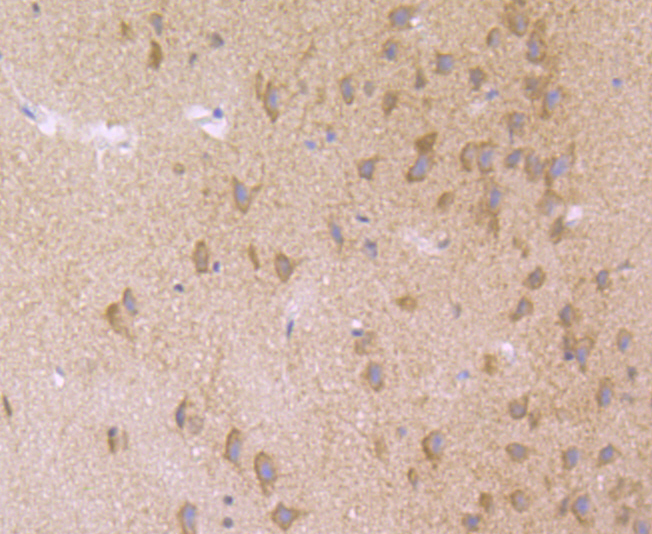 Paraformaldehyde-fixed and paraffin-embedded Rat Brain tissue incubated with THOC1 (7G3) Monoclonal Antibody (bsm-54202R) at 1:100, overnight at 4°C, followed by a conjugated secondary antibody and DAB staining. Counterstained with hematoxylin.