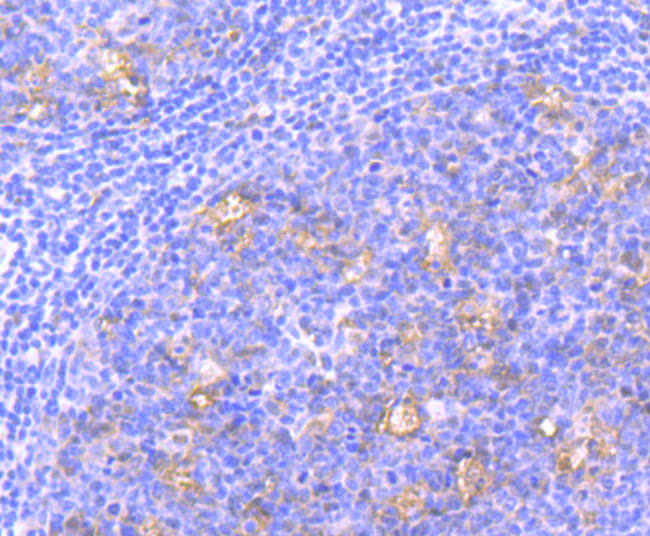 Paraformaldehyde-fixed and paraffin-embedded Human Tonsils tissue incubated with THOC1 (7G3) Monoclonal Antibody (bsm-54202R) at 1:100, overnight at 4°C, followed by a conjugated secondary antibody and DAB staining. Counterstained with hematoxylin.