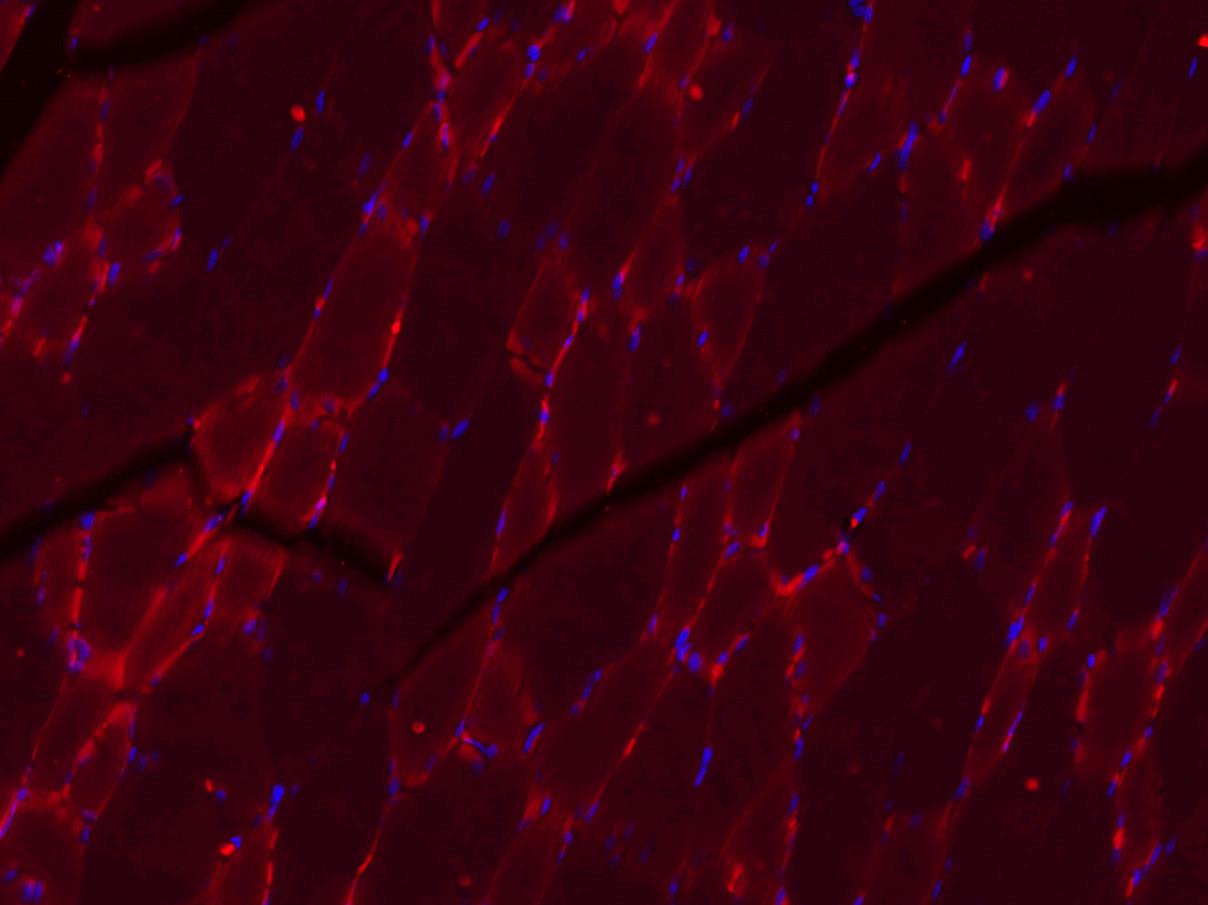 Paraformaldehyde-fixed, paraffin-embedded Rat Skeletal Muscle; Antigen retrieval by boiling in sodium citrate buffer (pH6.0) for 15min; Blocking buffer (normal goat serum) at 37°C for 30min; Antibody incubation with Collagen I Monoclonal Antibody, Unconjugated (bsm-33400M) at 1:400 overnight at 4°C, followed by a secondary antibody, Goat Anti-Mouse IgG antibody (bs-0296G-CY3) for 90 minutes, and DAPI for nuclei staining. Paraformaldehyde-fixed, paraffin-embedded Rat Skeletal Muscle; Antigen retrieval by boiling in sodium citrate buffer (pH6.0) for 15min; Blocking buffer (normal goat serum) at 37°C for 30min; Antibody incubation with Collagen I Monoclonal Antibody, Unconjugated (bsm-33400M) at 1:400 overnight at 4°C, followed by a secondary antibody, Goat Anti-Mouse IgG antibody (bs-0296G-CY3) for 90 minutes, and DAPI for nuclei staining.