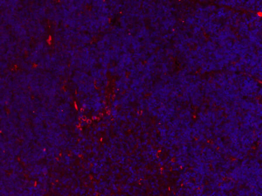 Paraformaldehyde-fixed, paraffin-embedded Rat Thymus; Antigen retrieval by boiling in sodium citrate buffer (pH6.0) for 15min; Blocking buffer (normal goat serum) at 37°C for 30min; Antibody incubation with Collagen I Monoclonal Antibody, Unconjugated (bsm-33400M) at 1:400 overnight at 4°C, followed by a secondary antibody, Goat Anti-Mouse IgG antibody (bs-0296G-CY3) for 90 minutes, and DAPI for nuclei staining.