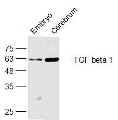 Lane 1: Mouse Embryo; Lane 2: Rat Cerebrum; Probed with TGF beta 1 Polyclonal Antibody, Unconjugated (bs-0086R) at 1:1000 dilution, overnight at 4˚C. Followed by secondary antibody incubation at 1:10000 for 60 min at 37˚C.
