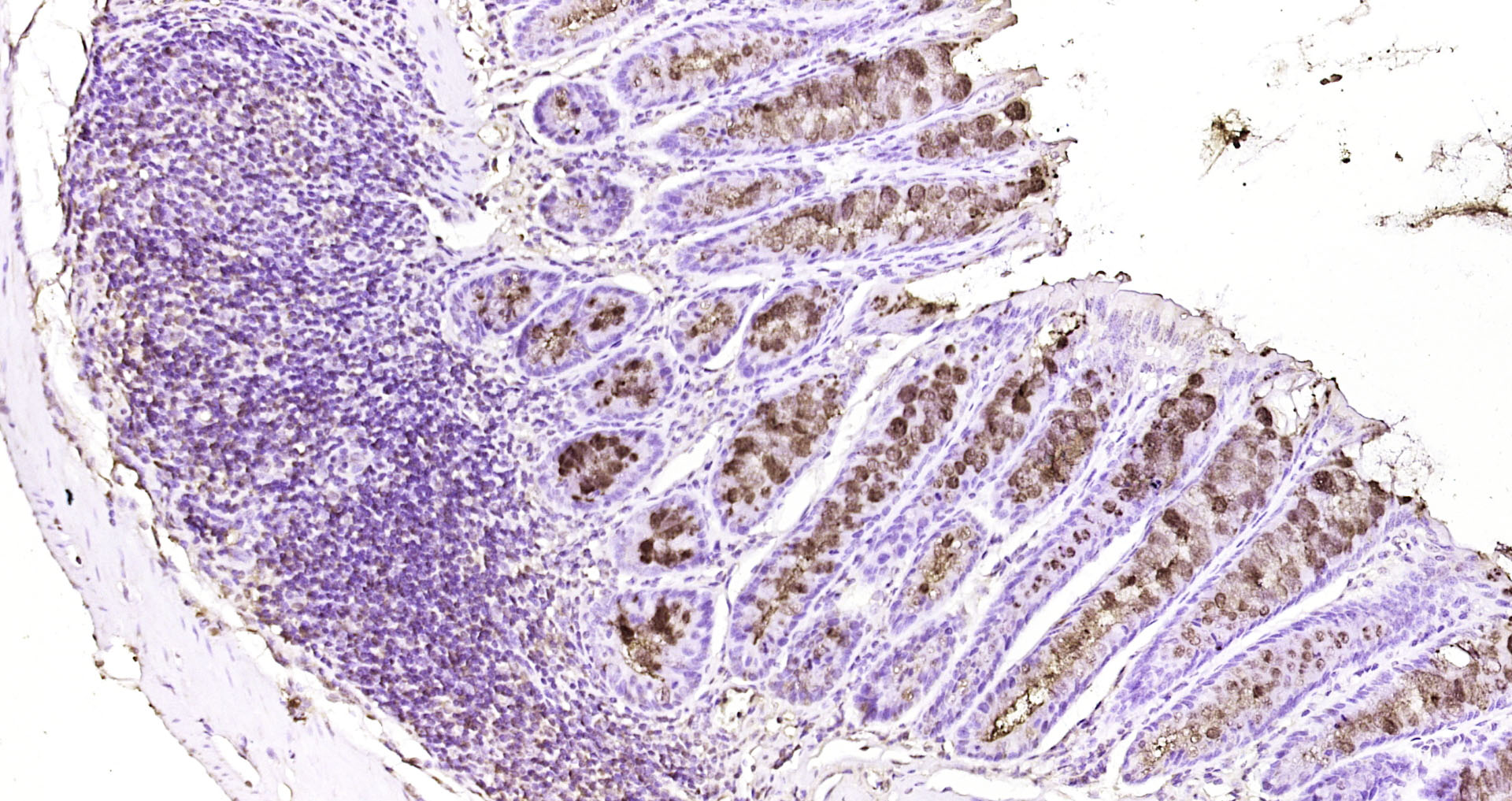 Paraformaldehyde-fixed, paraffin embedded Mouse colon; Antigen retrieval by boiling in sodium citrate buffer (pH6.0) for 15min; Block endogenous peroxidase by 3% hydrogen peroxide for 20 minutes; Blocking buffer (normal goat serum) at 37°C for 30min; Antibody incubation with FCGBP Polyclonal Antibody, Unconjugated (bs-13168R) at 1:200 overnight at 4°C, DAB staining.