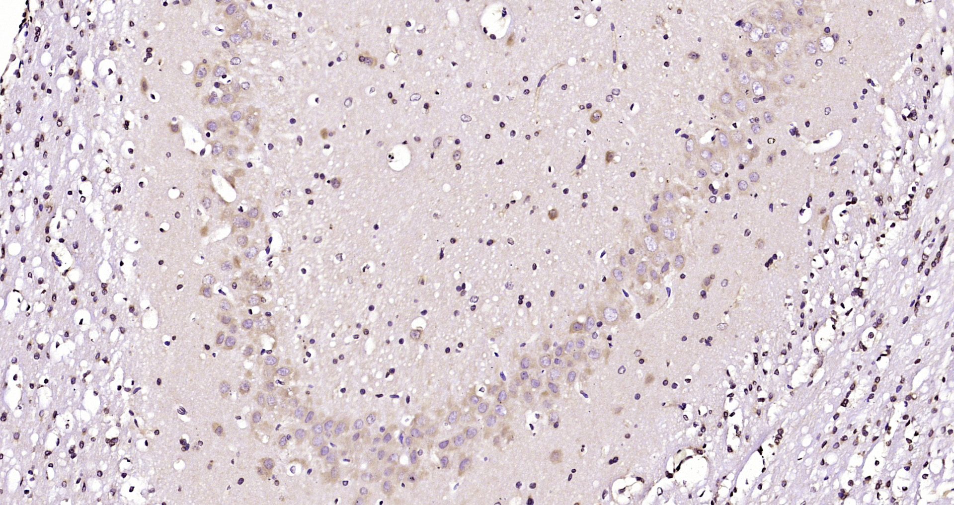 Paraformaldehyde-fixed, paraffin embedded Rat brain; Antigen retrieval by boiling in sodium citrate buffer (pH6.0) for 15min; Block endogenous peroxidase by 3% hydrogen peroxide for 20 minutes; Blocking buffer (normal goat serum) at 37°C for 30min; Antibody incubation with HERPUD1 Polyclonal Antibody, Unconjugated (bs-15464R) at 1:200 overnight at 4°C, DAB staining.