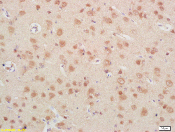 Formalin-fixed and paraffin embedded rat brain labeled with Rabbit Anti IGFBP6 Polyclonal Antibody, Unconjugated (bs-4064R) at 1:200 followed by conjugation to the secondary antibody and DAB staining