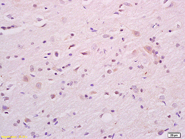 Formalin-fixed and paraffin embedded rat brain tissue labeled with Anti CKAP4 Polyclonal Antibody,Unconjugated (bs-6520R) at 1:200 followed by conjugation to the secondary antibody and DAB staining.