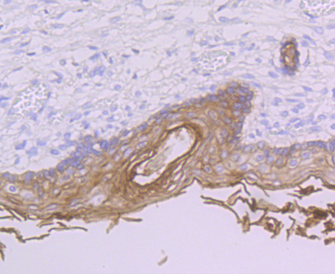 Paraformaldehyde-fixed and paraffin-embedded Human Skin tissue incubated with PERP (4C2) Monoclonal Antibody (bsm-54209R) at 1:100, overnight at 4°C, followed by a conjugated secondary antibody and DAB staining. Counterstained with hematoxylin.
