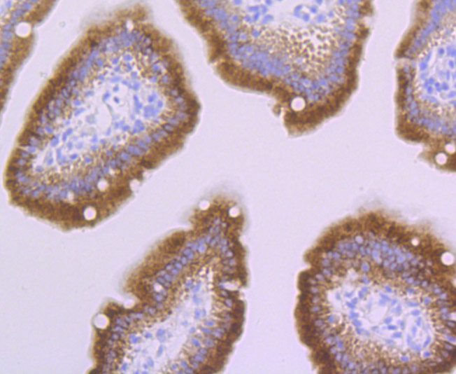 Paraformaldehyde-fixed and paraffin-embedded Mouse Small Intestine tissue incubated with PERP (4C2) Monoclonal Antibody (bsm-54209R) at 1:100, overnight at 4°C, followed by a conjugated secondary antibody and DAB staining. Counterstained with hematoxylin.