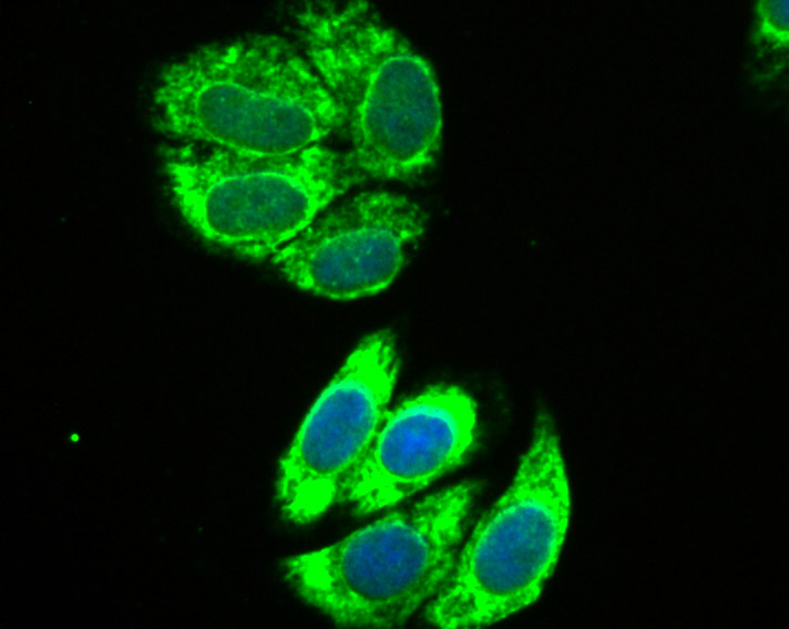 IF(ICC) staining with IL13 Receptor alpha 1 (1C1) Monoclonal Antibody (bsm-54211R) at 1:200 in HepG2 cells (green). The nuclear counterstain is DAPI (blue). Cells were fixed in paraformaldehyde, permeabilized with 0.25% Triton X100/PBS.