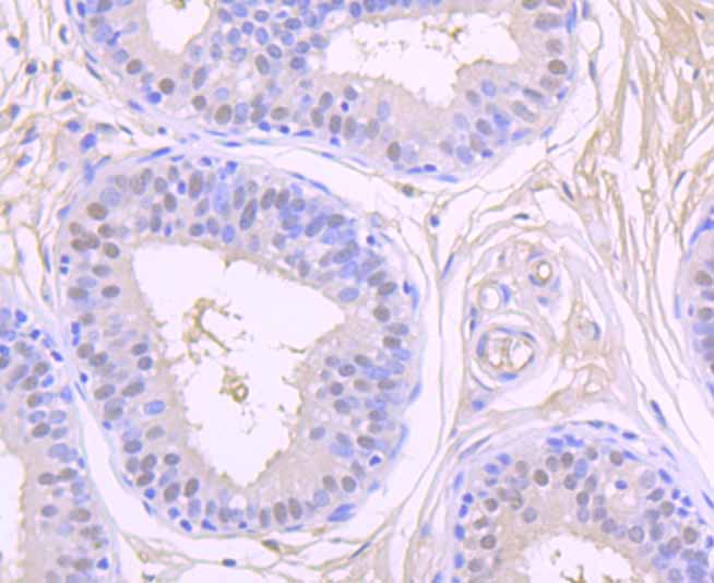 Paraformaldehyde-fixed and paraffin-embedded Human Breast tissue incubated with CSNK2B (2C9) Monoclonal Antibody (bsm-54217R) at 1:100, overnight at 4°C, followed by a conjugated secondary antibody and DAB staining. Counterstained with hematoxylin.