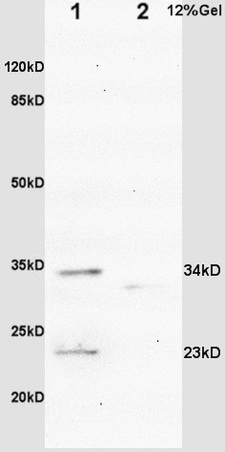 L1 rat brain lysates L2 mouse intestine lysates probed with Anti IGFBP6 Polyclonal Antibody, Unconjugated (bs-4064R) at 1:200 overnight at 4˚C. Followed by conjugation to secondary antibody (bs-0295G-HRP) at 1:3000 for 90 min at 37˚C. Predicted band 23kD. Observed band size:23kD.\\n
