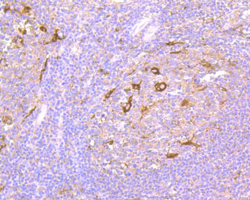 Paraformaldehyde-fixed and paraffin-embedded Human Tonsil tissue incubated with NCK1 (7C2) Monoclonal Antibody (bsm-54207R) at 1:100, overnight at 4°C, followed by a conjugated secondary antibody and DAB staining. Counterstained with hematoxylin.