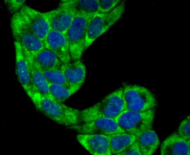 IF(ICC) staining with Villin-1 (5C1) Monoclonal Antibody (bsm-54212R) at 1:100 in Hela cells (green). The nuclear counterstain is DAPI (blue). Cells were fixed in paraformaldehyde, permeabilized with 0.25% Triton X100/PBS.