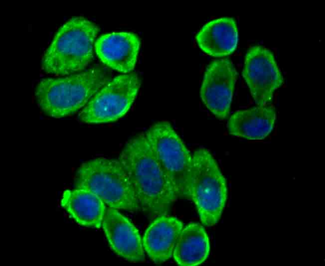IF(ICC) staining with Villin-1 (5C1) Monoclonal Antibody (bsm-54212R) at 1:100 in HepG2 cells (green). The nuclear counterstain is DAPI (blue). Cells were fixed in paraformaldehyde, permeabilized with 0.25% Triton X100/PBS.