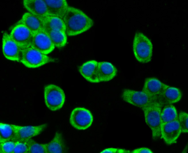 IF(ICC) staining with Villin-1 (5C1) Monoclonal Antibody (bsm-54212R) at 1:100 in LOVO cells (green). The nuclear counterstain is DAPI (blue). Cells were fixed in paraformaldehyde, permeabilized with 0.25% Triton X100/PBS.