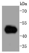 Hela cell lysate probed with MEK5 (5C6) Monoclonal Antibody (bsm-52665R) at 1:1000 overnight at 4°C followed by a conjugated secondary antibody for 60 minutes at 37°C.