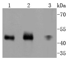 Lane 1:Hela Cells; Lane 2: 293T Cells; Lane 3: A431 Cells; Probed with MEK7 (7C6) Monoclonal Antibody (bsm-52666R) at 1:1000 overnight at 4°C followed by a conjugated secondary antibody for 60 minutes at 37°C.