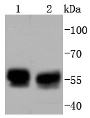 Lane 1: 293T Cells; Lane 2: Hela Cells; Probed with TRK fused gene (5C1) Monoclonal Antibody (bsm-52676R) at 1:1000 overnight at 4°C followed by a conjugated secondary antibody for 60 minutes at 37°C.