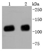 Lane 1: HepG2 Cells; Lane 2: Hela Cells; Probed with KAP1 (7C5) Monoclonal Antibody (bsm-52679R) at 1:1000 overnight at 4°C followed by a conjugated secondary antibody for 60 minutes at 37°C.
