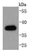 A431 cell lysate probed with AMPK beta 1 (6C1) Monoclonal Antibody (bsm-52680R) at 1:1000 overnight at 4°C followed by a conjugated secondary antibody for 60 minutes at 37°C.