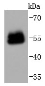 Mouse eye lysate probed with PAX6 (8T3) Monoclonal Antibody (bsm-52682R) at 1:1000 overnight at 4°C followed by a conjugated secondary antibody for 60 minutes at 37°C.