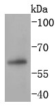 Hela cell lysates probed with PAX7 (6C2) Monoclonal Antibody (bsm-52685R) at 1:1000 overnight at 4°C followed by a conjugated secondary antibody for 60 minutes at 37°C.