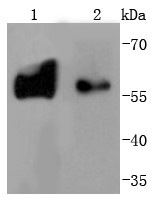 Lane 1: PC-12 Cells; Lane 2: Mouse brain; Probed with Tyrosine Hydroxylase (3T1) Monoclonal Antibody (bsm-52689R) at 1:1000 overnight at 4°C followed by a conjugated secondary antibody for 60 minutes at 37°C.