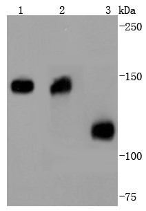 Lane 1: Mouse heart; Lane 2: Human heart; Lane 3: Human kidney; Probed with Collagen VI (9C1) Monoclonal Antibody (bsm-52703R) at 1:1000 overnight at 4°C followed by a conjugated secondary antibody for 60 minutes at 37°C. Lane 1: Mouse heart; Lane 2: Human heart; Lane 3: Human kidney; Probed with Collagen VI (9C1) Monoclonal Antibody (bsm-52703R) at 1:1000 overnight at 4°C followed by a conjugated secondary antibody for 60 minutes at 37°C.