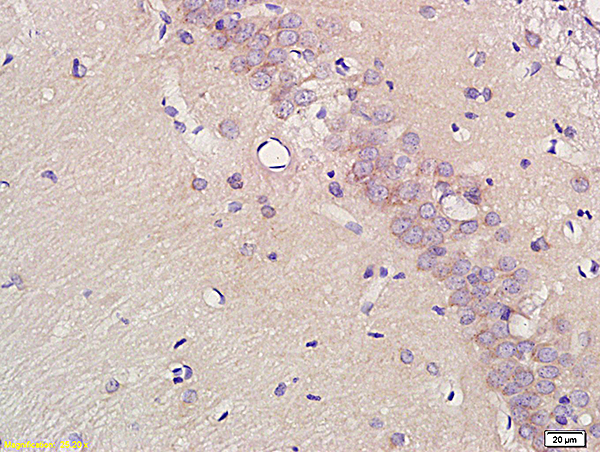 Formalin-fixed and paraffin embedded rat brain labeled with  Anti-EAAT2, Unconjugated(bs-1751R) at 1:200, followed by conjugation to the secondary antibody and DAB staining