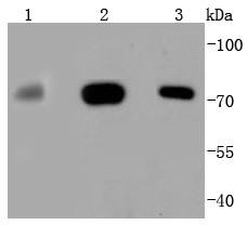 Lane 1: Hela Cells; Lane 2: 293T Cells; Lane 3: A431 Cells; Probed with MEKK3 (5C1) Monoclonal Antibody (bsm-54089R) at 1:1000 overnight at 4°C followed by a conjugated secondary antibody for 60 minutes at 37°C.