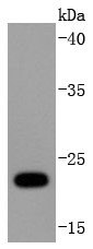 Hela cells Probed with Ubiquitin D (5C1) Monoclonal Antibody (bsm-52778R) at 1:1000 overnight at 4°C followed by a conjugated secondary antibody for 60 minutes at 37°C.