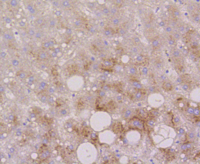 Paraformaldehyde-fixed and paraffin-embedded Human liver tissue incubated with LAMP2a (2C4) Monoclonal Antibody (bsm-52255R) at 1:100, overnight at 4°C, followed by a conjugated secondary antibody and DAB staining. Counterstained with hematoxylin.