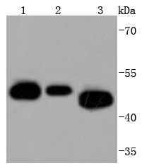 Lane 1: Jurkat Cells; Lane 2: A431 Cells; Lane 3: K562 Cells; Probed with Cdc37 (4C4) Monoclonal Antibody (bsm-52713R) at 1:1000 overnight at 4°C followed by a conjugated secondary antibody for 60 minutes at 37°C.