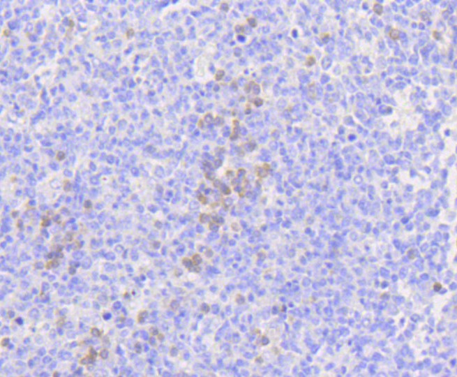 Paraformaldehyde-fixed and paraffin-embedded Human tonsil tissue incubated with MLKL (3G4) Monoclonal Antibody (bsm-52256R) at 1:100, overnight at 4°C, followed by a conjugated secondary antibody and DAB staining. Counterstained with hematoxylin.